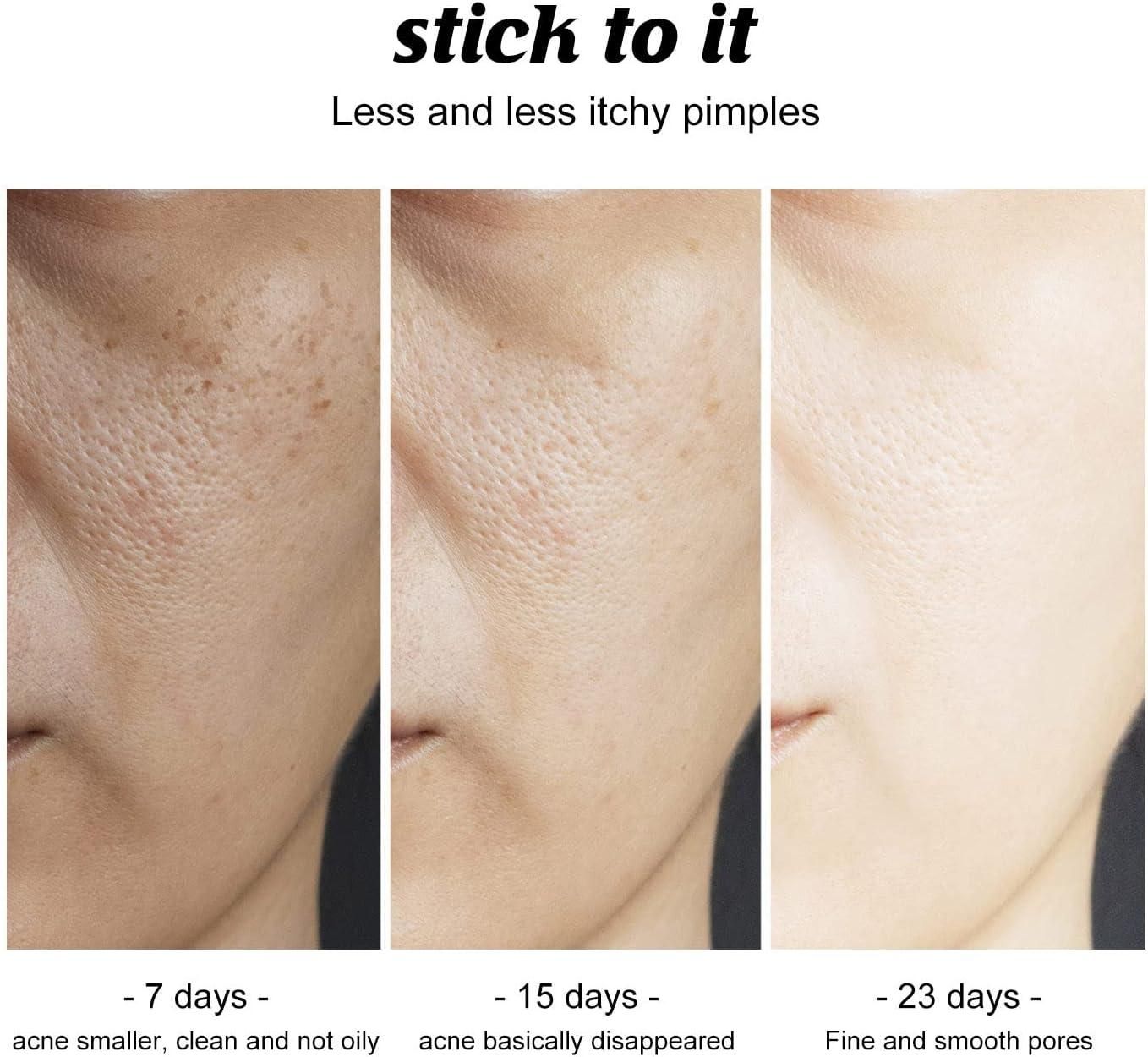 Charcoal Cleansing and Deep Face and Soap Natural Bath Skin - Luxury Ways