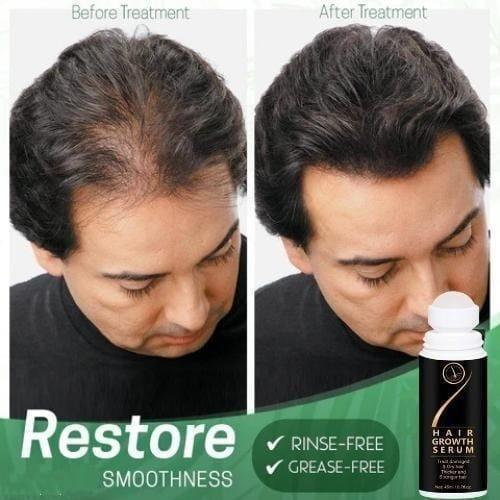 Hair Growth Serum 45ml (Multiple Packs) - Luxury Ways